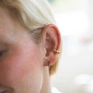 Nausznica winogrona - zdjęcie 1