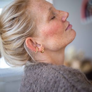 Nausznica skręcona - zdjęcie 1